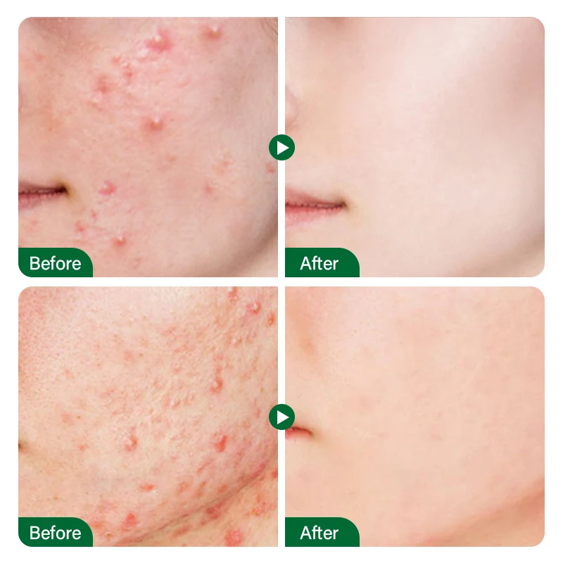 Skin Care